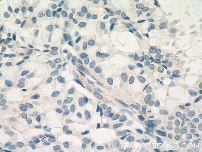 SMMHC Antibody in Immunohistochemistry (Paraffin) (IHC (P))