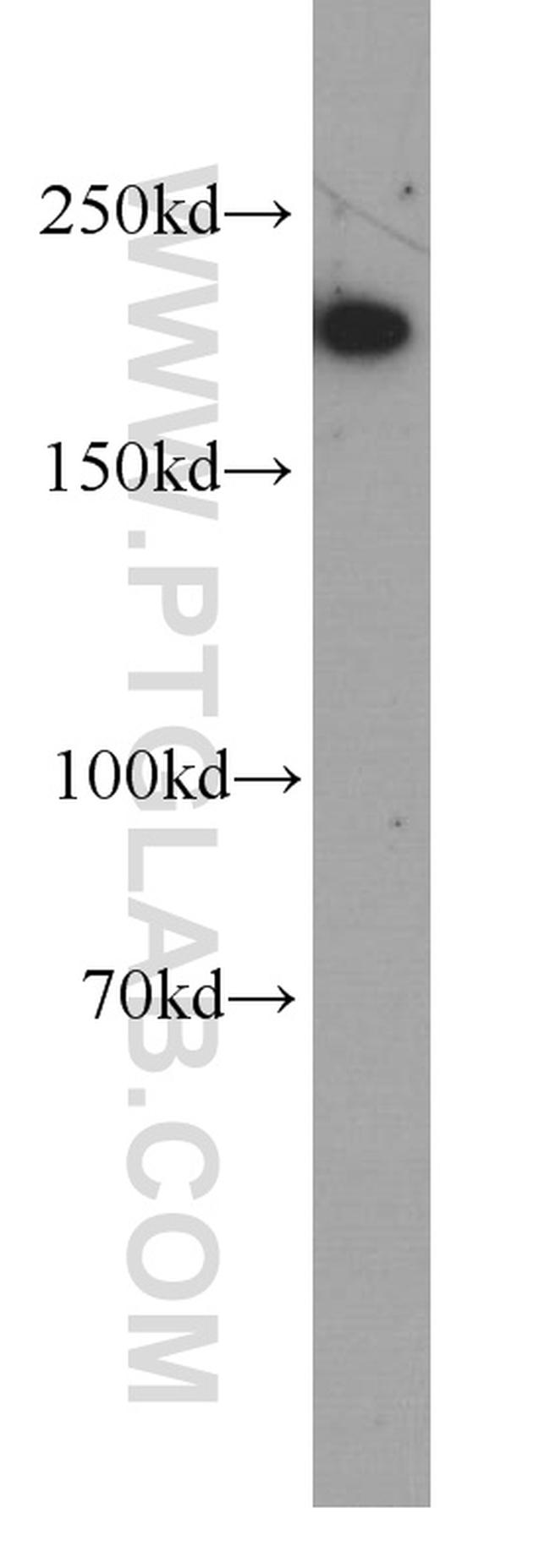 SMMHC Antibody in Western Blot (WB)