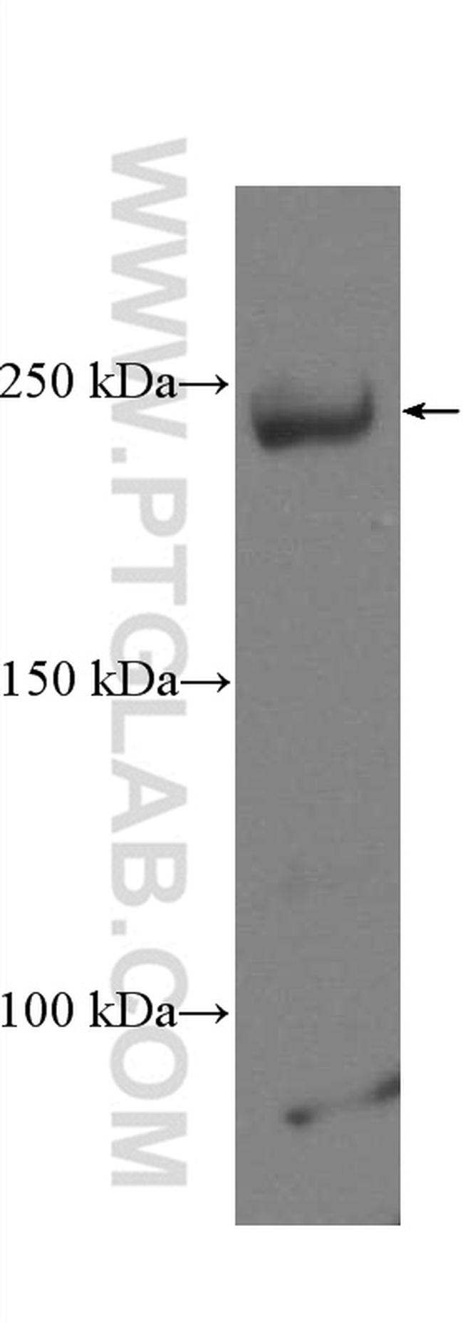 SMMHC Antibody in Western Blot (WB)