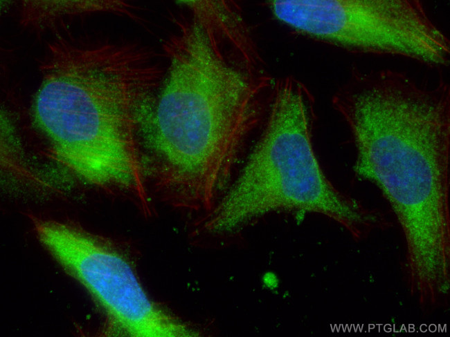 Galectin-1 Antibody in Immunocytochemistry (ICC/IF)