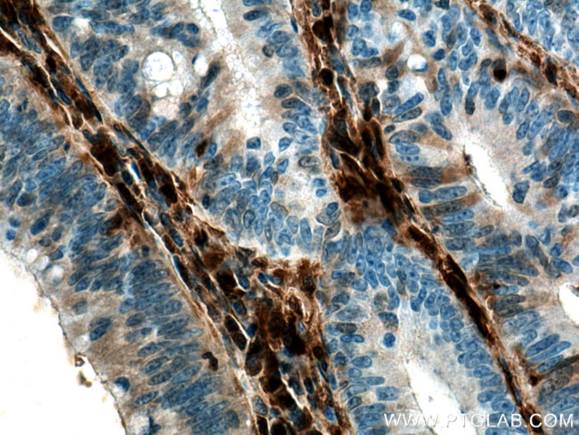 Galectin-1 Antibody in Immunohistochemistry (Paraffin) (IHC (P))