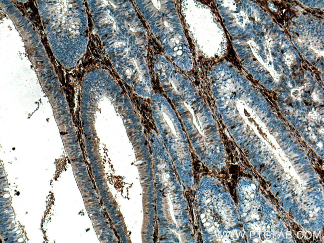 Galectin-1 Antibody in Immunohistochemistry (Paraffin) (IHC (P))