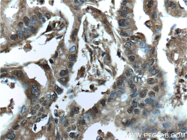 Galectin-1 Antibody in Immunohistochemistry (Paraffin) (IHC (P))