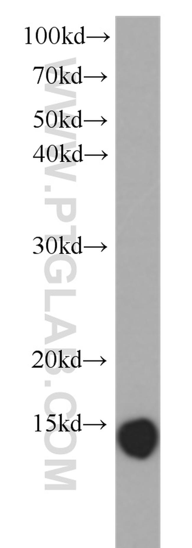 Galectin-1 Antibody in Western Blot (WB)