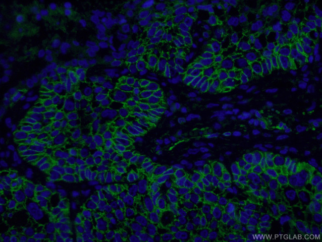 CD44 Antibody in Immunohistochemistry (PFA fixed) (IHC (PFA))