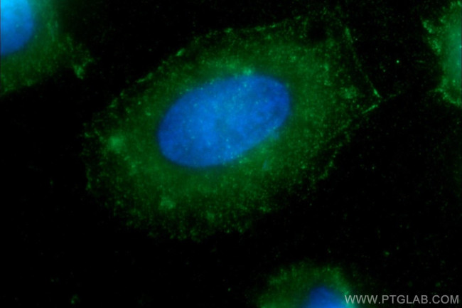 CD44 Antibody in Immunocytochemistry (ICC/IF)