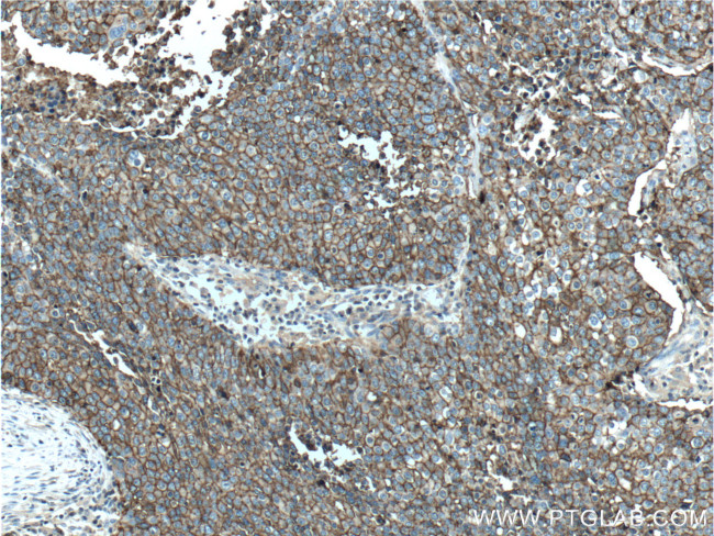 CD44 Antibody in Immunohistochemistry (Paraffin) (IHC (P))