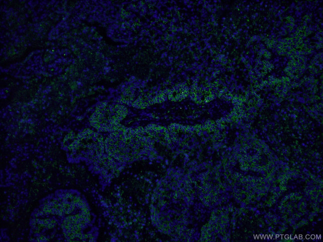 CD44 Antibody in Immunohistochemistry (PFA fixed) (IHC (PFA))