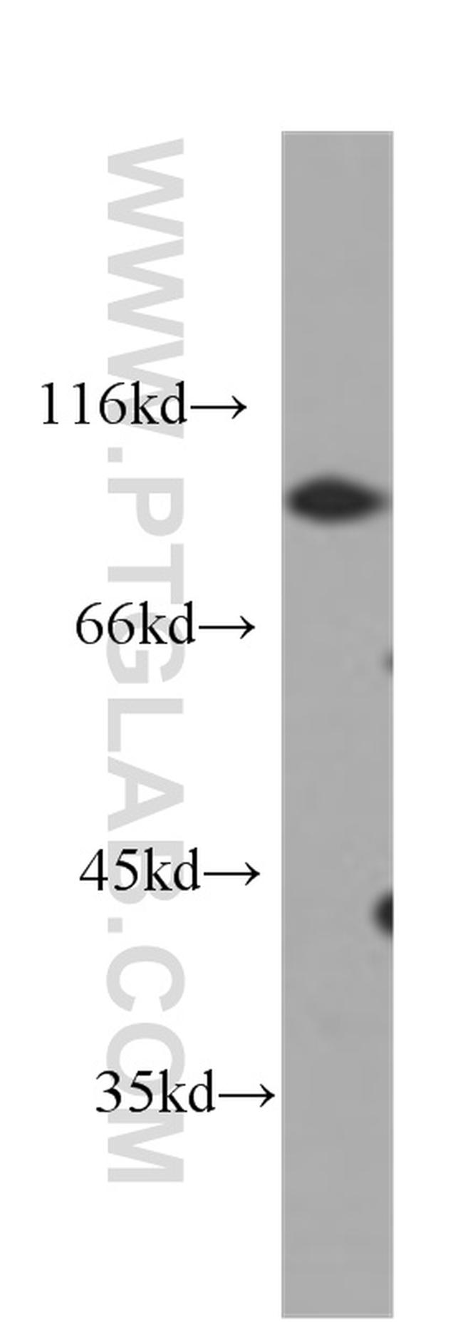 CD44 Antibody in Western Blot (WB)