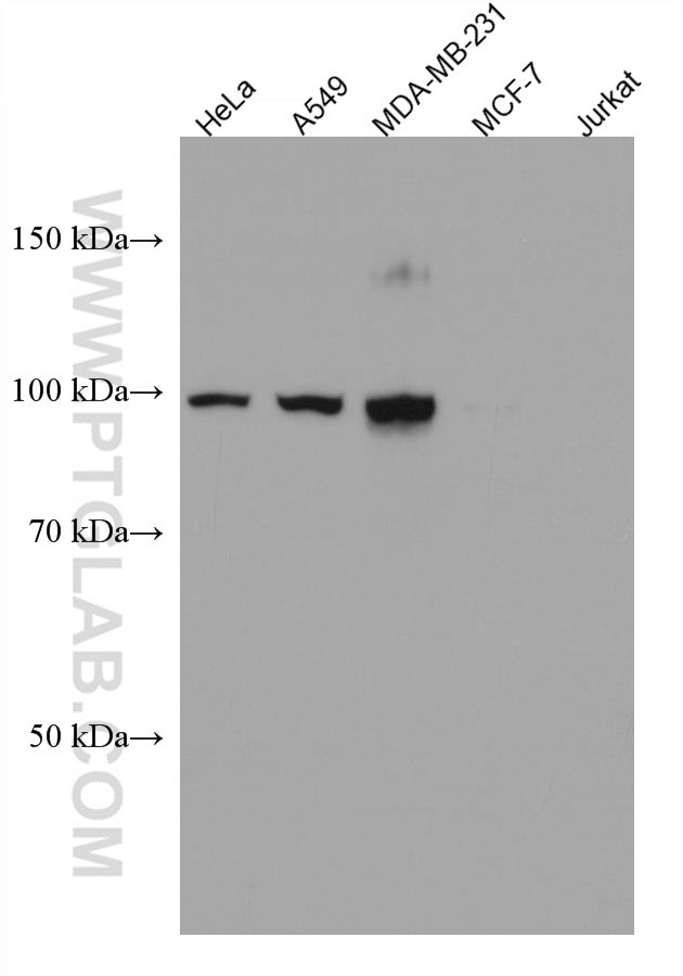 CD44 Antibody in Western Blot (WB)