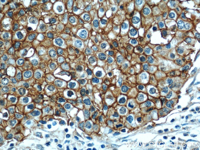 CD44 Antibody in Immunohistochemistry (Paraffin) (IHC (P))