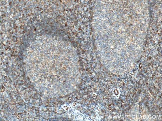 CD44 Antibody in Immunohistochemistry (Paraffin) (IHC (P))