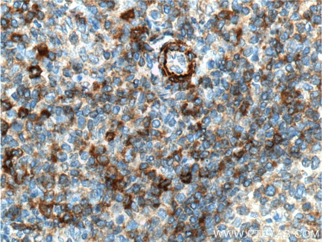 CD44 Antibody in Immunohistochemistry (Paraffin) (IHC (P))