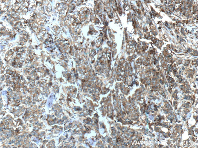 CD44 Antibody in Immunohistochemistry (Paraffin) (IHC (P))