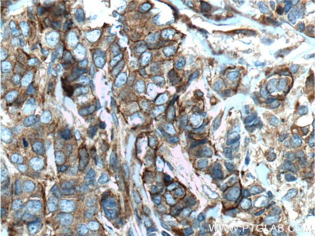 CD44 Antibody in Immunohistochemistry (Paraffin) (IHC (P))