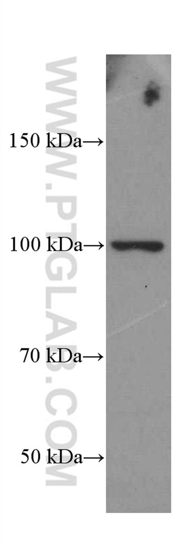 CD44 Antibody in Western Blot (WB)