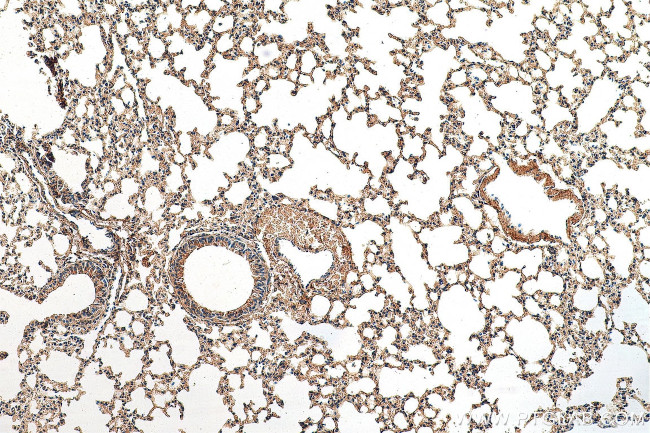 PI3K p85 alpha Antibody in Immunohistochemistry (Paraffin) (IHC (P))