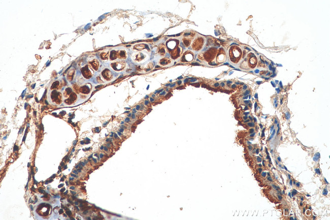 PI3K p85 alpha Antibody in Immunohistochemistry (Paraffin) (IHC (P))