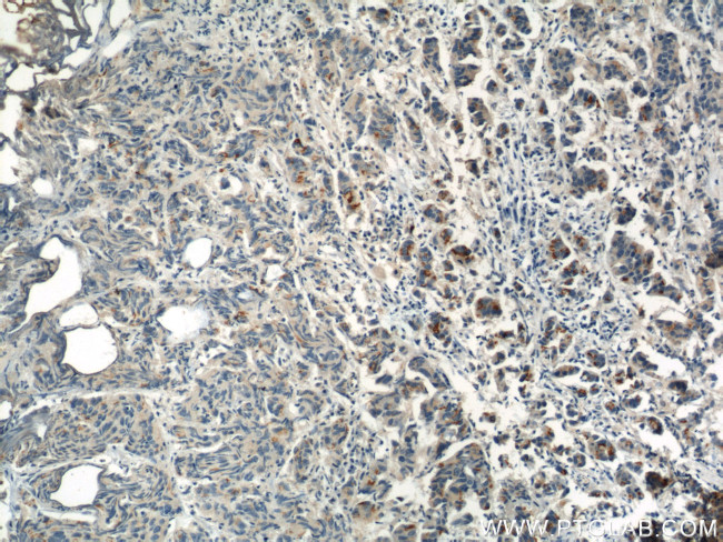 PI3K p85 alpha Antibody in Immunohistochemistry (Paraffin) (IHC (P))