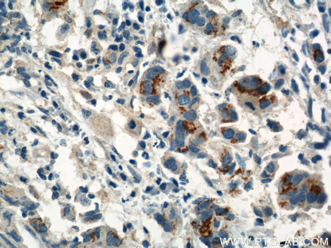 PI3K p85 alpha Antibody in Immunohistochemistry (Paraffin) (IHC (P))