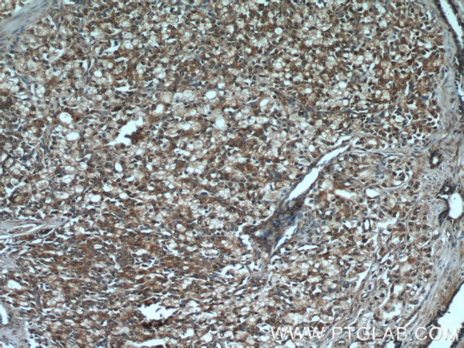 PI3K p85 alpha Antibody in Immunohistochemistry (Paraffin) (IHC (P))