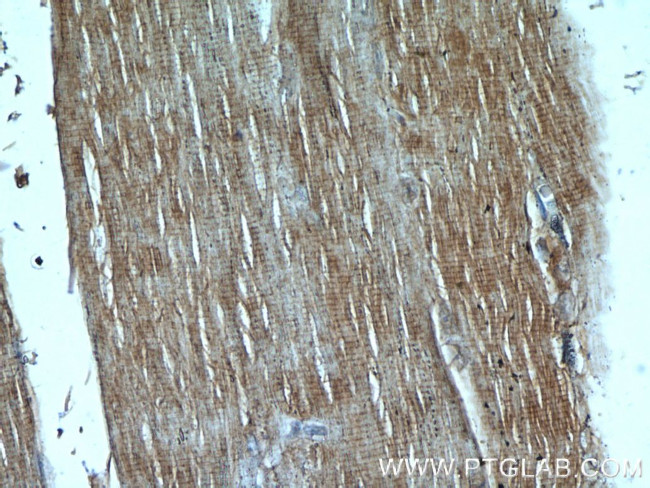 PI3K p85 alpha Antibody in Immunohistochemistry (Paraffin) (IHC (P))