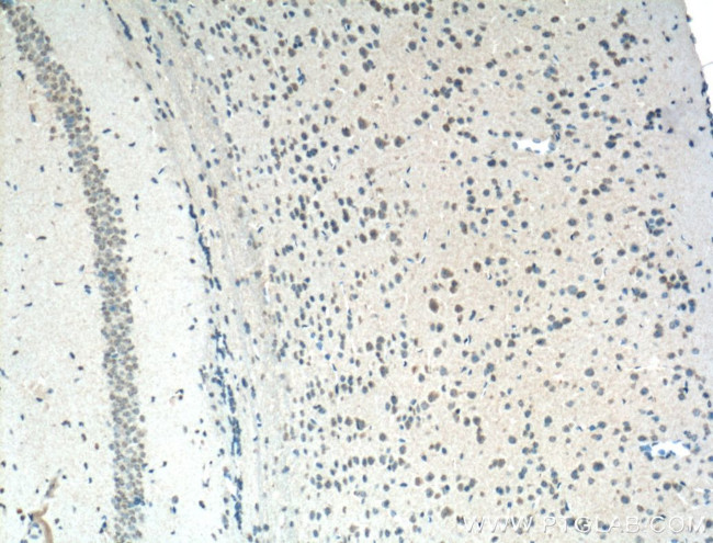 PI3K p85 alpha Antibody in Immunohistochemistry (Paraffin) (IHC (P))