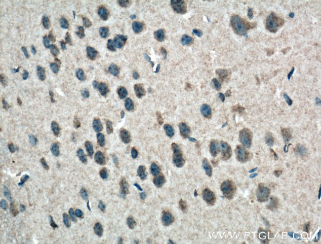 PI3K p85 alpha Antibody in Immunohistochemistry (Paraffin) (IHC (P))