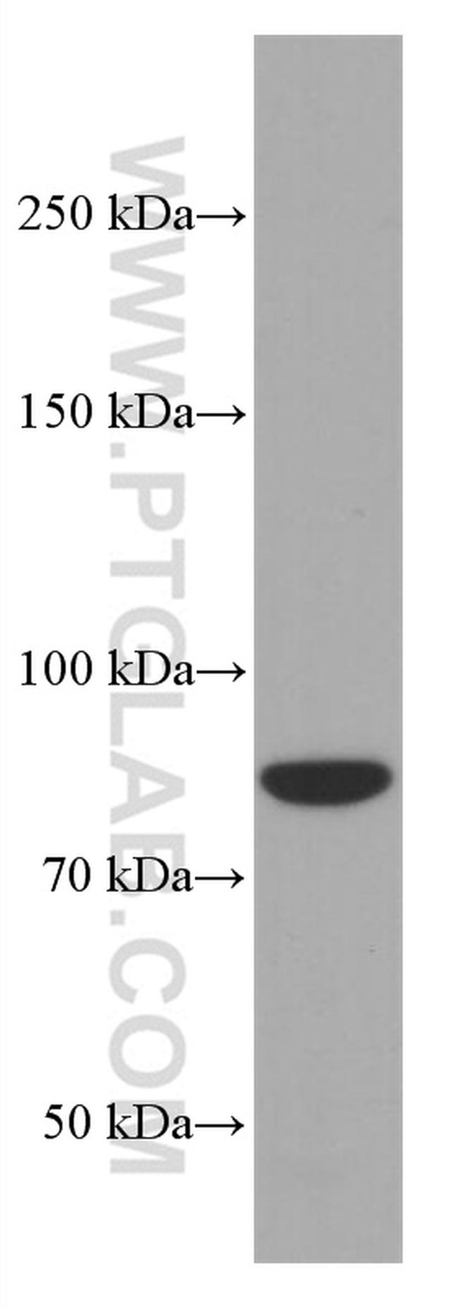 PI3K p85 alpha Antibody in Western Blot (WB)