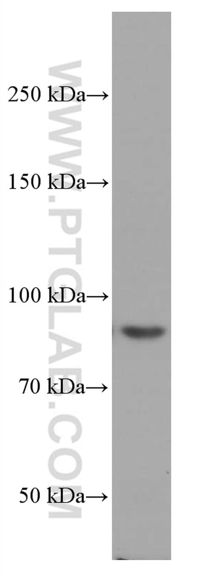 PI3K p85 alpha Antibody in Western Blot (WB)