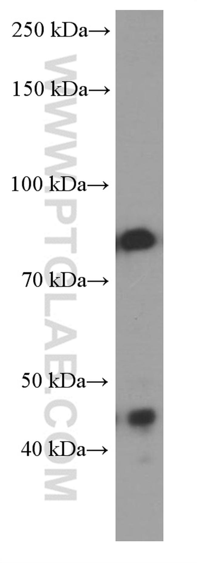 PI3K p85 alpha Antibody in Western Blot (WB)