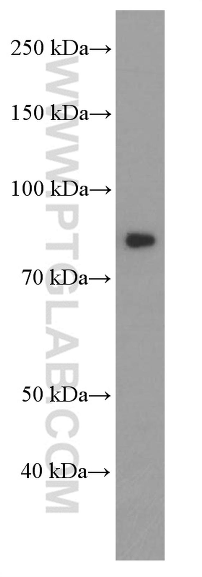 PI3K p85 alpha Antibody in Western Blot (WB)