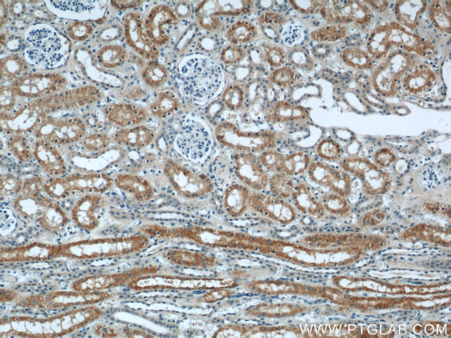 IFT88 Antibody in Immunohistochemistry (Paraffin) (IHC (P))