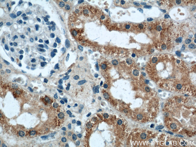 IFT88 Antibody in Immunohistochemistry (Paraffin) (IHC (P))