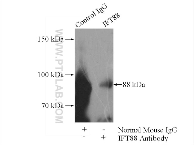 IFT88 Antibody in Immunoprecipitation (IP)