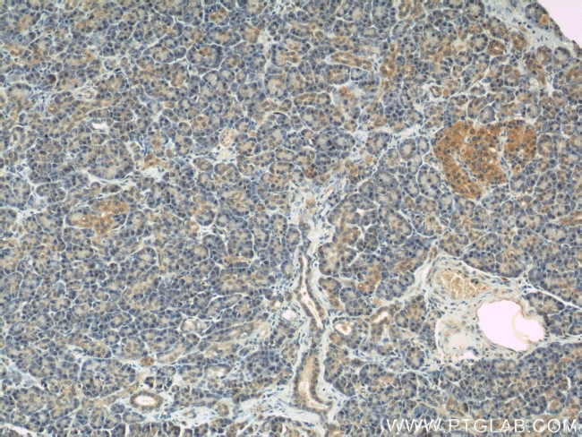 IFT88 Antibody in Immunohistochemistry (Paraffin) (IHC (P))