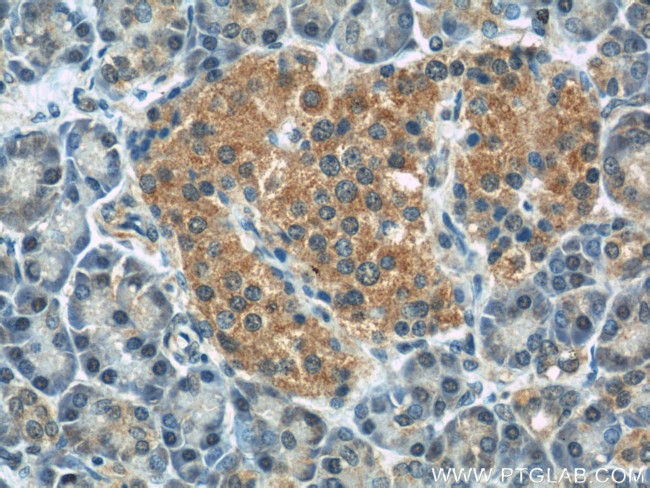 IFT88 Antibody in Immunohistochemistry (Paraffin) (IHC (P))