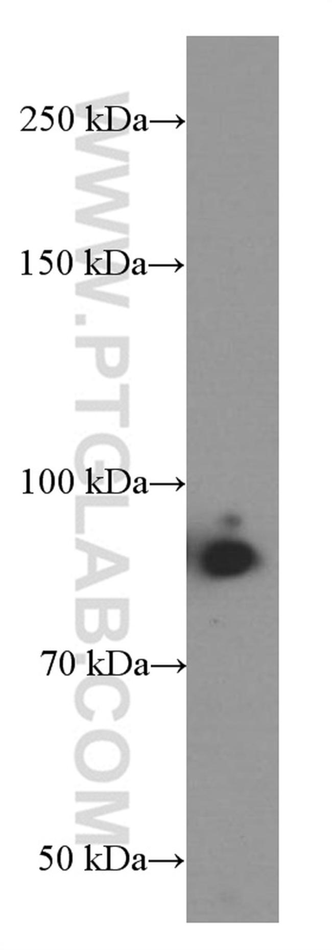 IFT88 Antibody in Western Blot (WB)