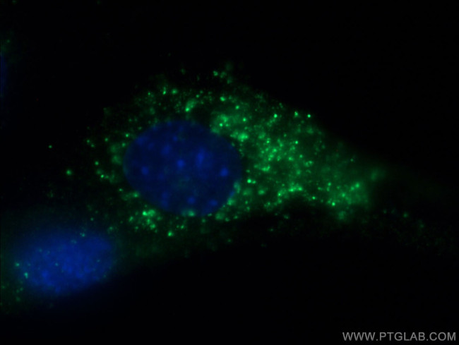 Myosin Light Chain 2 Antibody in Immunocytochemistry (ICC/IF)