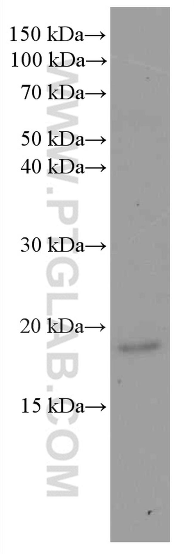 Myosin Light Chain 2 Antibody in Western Blot (WB)