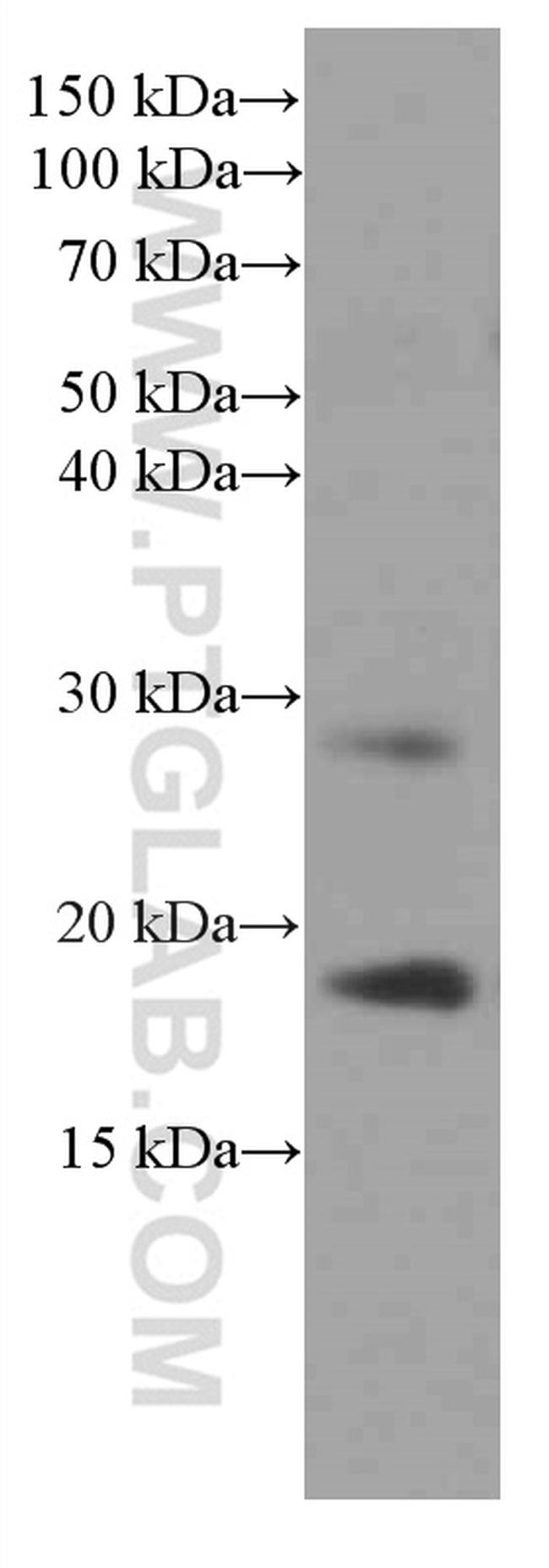 Myosin Light Chain 2 Antibody in Western Blot (WB)