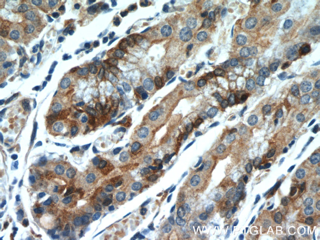 FUT9 Antibody in Immunohistochemistry (Paraffin) (IHC (P))