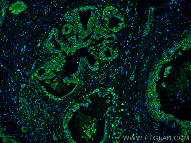 FUT9 Antibody in Immunohistochemistry (PFA fixed) (IHC (PFA))