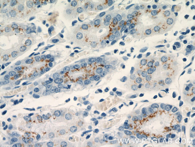 FUT9 Antibody in Immunohistochemistry (Paraffin) (IHC (P))