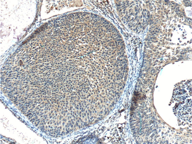 FUT9 Antibody in Immunohistochemistry (Paraffin) (IHC (P))