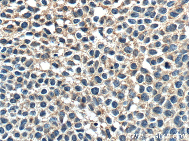 FUT9 Antibody in Immunohistochemistry (Paraffin) (IHC (P))