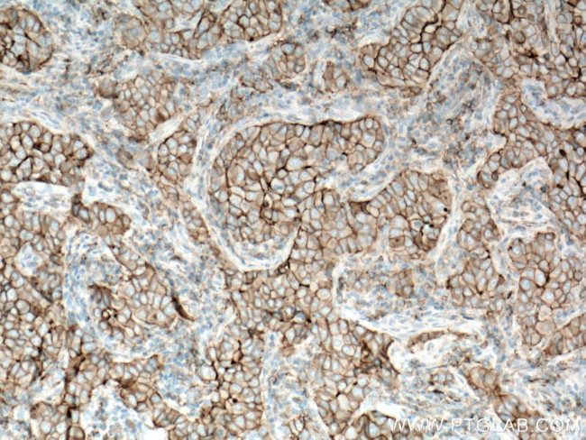 CD9 Antibody in Immunohistochemistry (Paraffin) (IHC (P))