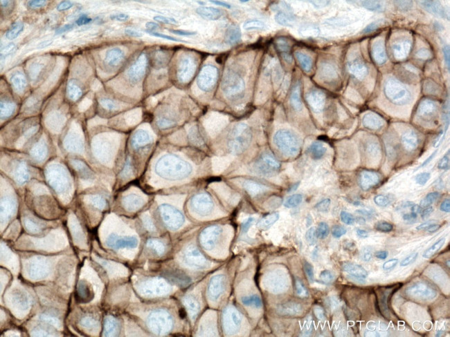 CD9 Antibody in Immunohistochemistry (Paraffin) (IHC (P))