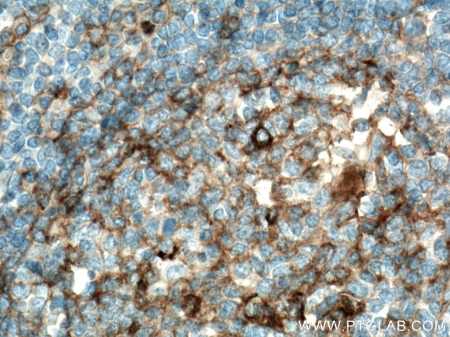 CD9 Antibody in Immunohistochemistry (Paraffin) (IHC (P))