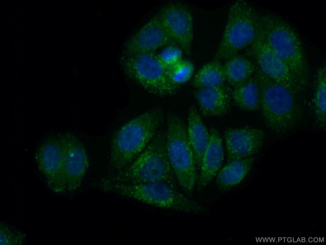 Gamma cystathionase Antibody in Immunocytochemistry (ICC/IF)